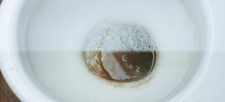 how-to-clean-a-very-stained-toilet-bowl